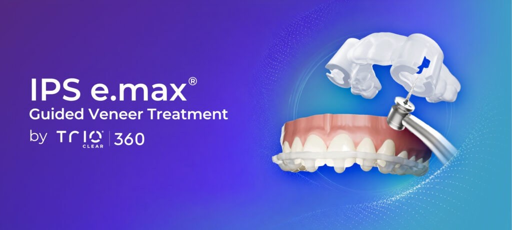IPS e.max Guided Veneers Product Header